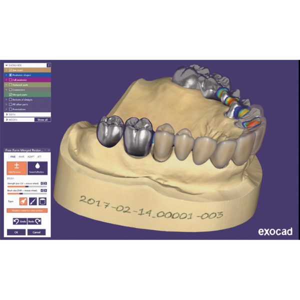 Exocad